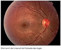 vorschau_blick_ins_auge